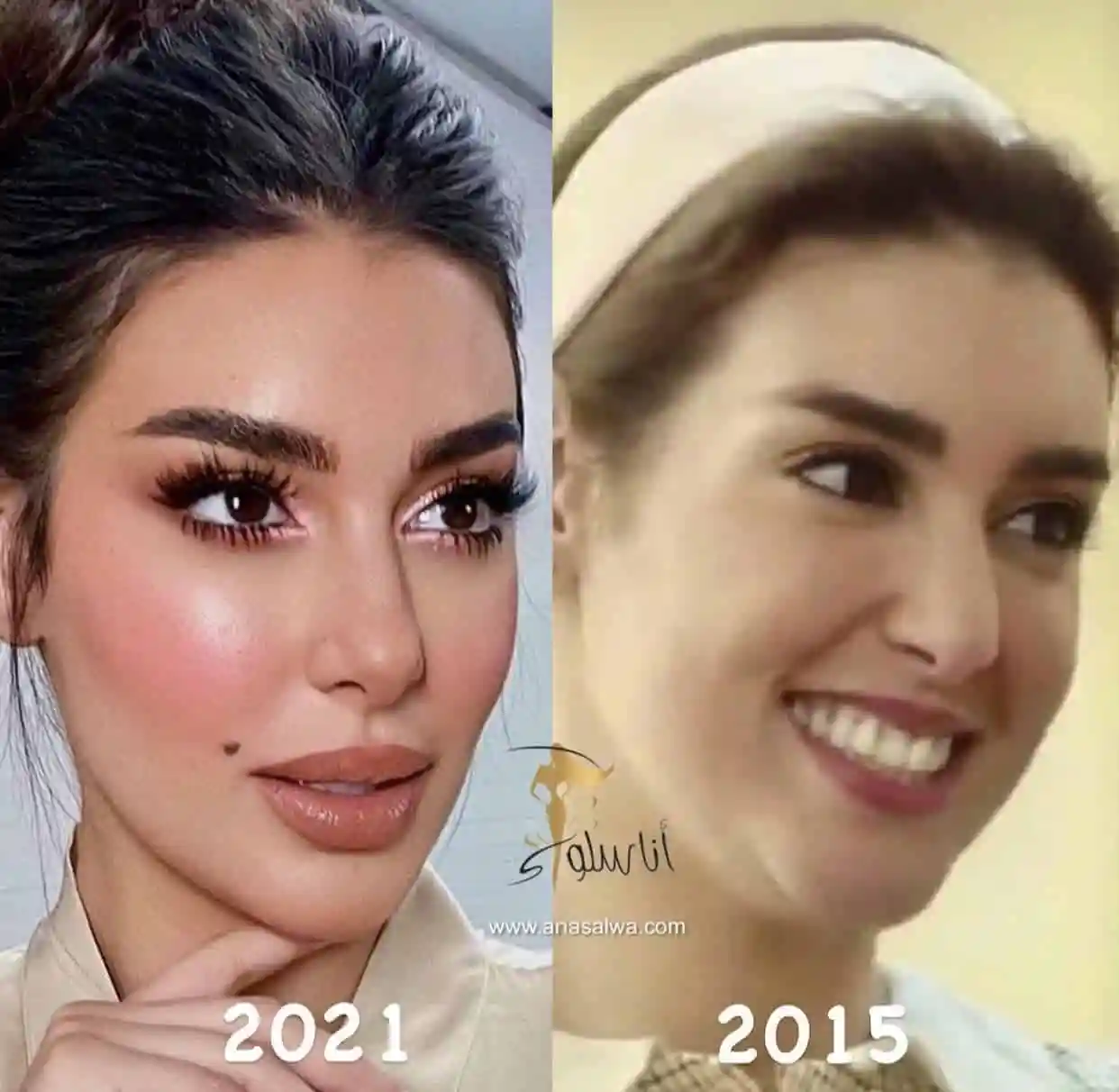 أبرز الإجراءات التجميلية التي خضعت لها الجميلة ياسمين صبري ✨