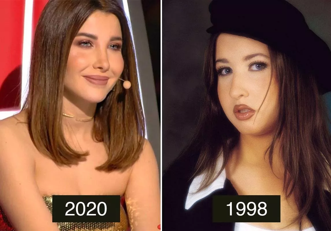 نانسي عجرم بين الماضي والحاضر: أبرز الإجراءات التجميلية للفنانة نانسي عجرم