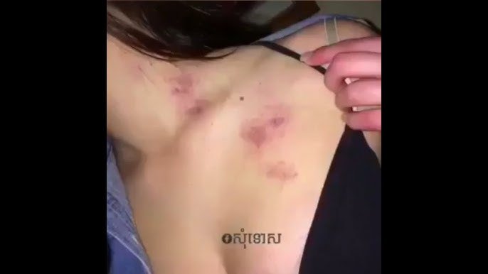 عضة الحب.. المُقبلات الرائعة للممارسة الجنسية