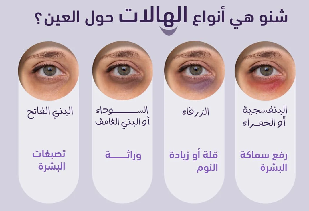 اختبار بسيط يكشف لك نوع هالاتك وطرق العلاج المناسبة لها