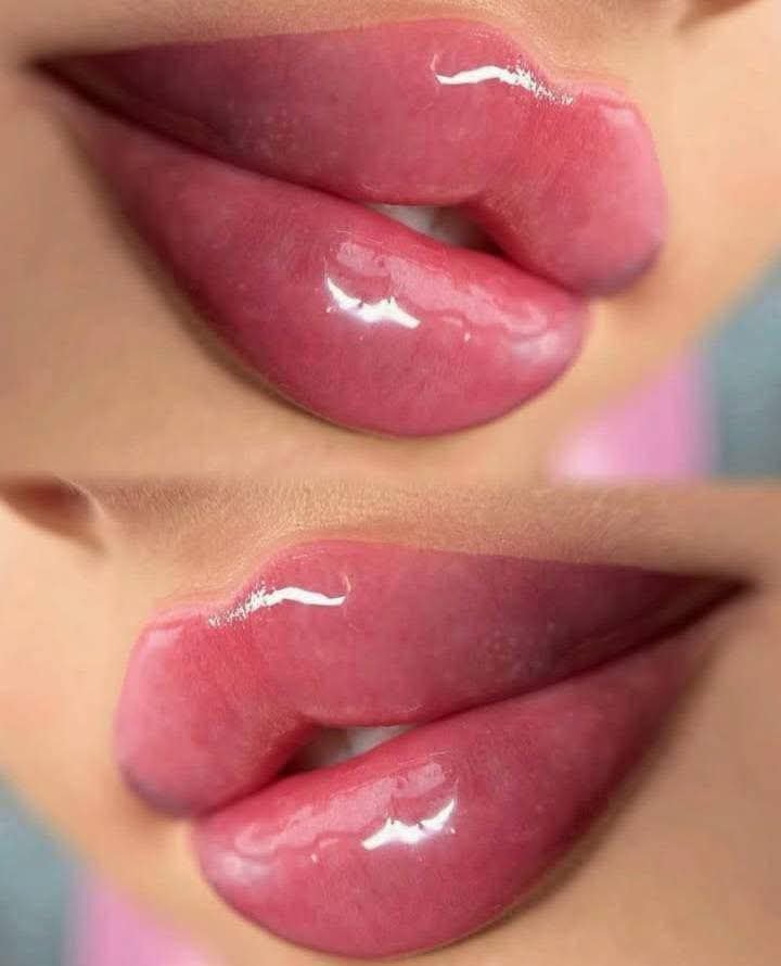 أفضل أنواع فيلر الشفاه بأسعار مناسبة